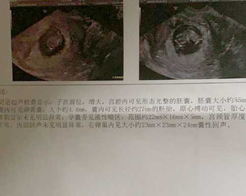 广州代孕网站大全|汕头三代试管婴儿医院费用有哪些？汕头三代试管婴儿的具