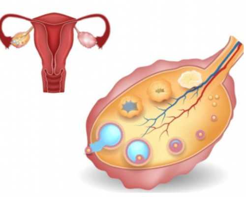 三代助孕试管排名_三代试管成功高吗,高龄女性泰国试管婴儿胚胎质量差应该怎